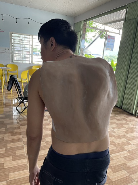 Khám phá áo gù của anh Mô trong Mẹ rơm và sự hết lòng vì vai diễn của Thái Hòa - Ảnh 2. Khám phá áo gù của anh Mô trong Mẹ rơm và sự hết lòng vì vai diễn của Thái Hòa - Ảnh 2.