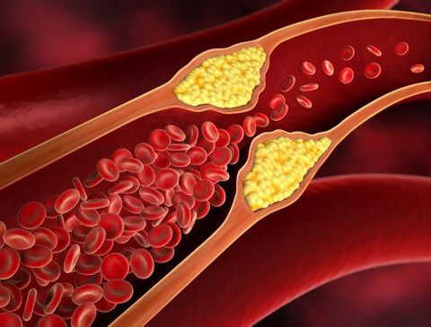Các phát hiện mới liên quan tới lượng cholesterol trong máu - Ảnh 1. Các phát hiện mới liên quan tới lượng cholesterol trong máu - Ảnh 1.