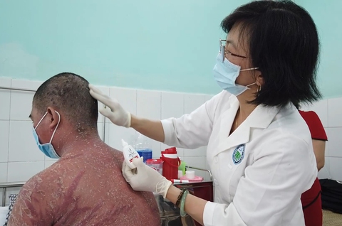 Da bong tróc toàn thân vì sử dụng thuốc trị vảy nến mua trên mạng - Ảnh 1. Da bong tróc toàn thân vì sử dụng thuốc trị vảy nến mua trên mạng - Ảnh 1.