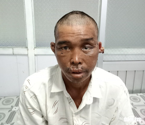 Vụ ngư dân bị hành hạ dã man: Sẽ làm rõ hành vi của chủ tàu cá - Ảnh 1. Vụ ngư dân bị hành hạ dã man: Sẽ làm rõ hành vi của chủ tàu cá - Ảnh 1.