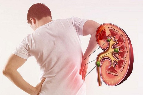 Nguy cơ suy thận do đái tháo đường, tim mạch và cách xử trí - Ảnh 3. Nguy cơ suy thận do đái tháo đường, tim mạch và cách xử trí - Ảnh 3.