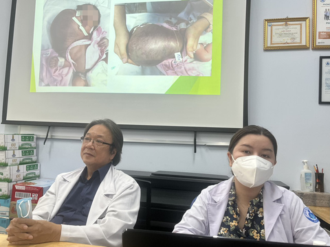 Phẫu thuật bướu khủng ở mặt, cổ, ngực cho bé trai 3 ngày tuổi - Ảnh 1. Phẫu thuật bướu khủng ở mặt, cổ, ngực cho bé trai 3 ngày tuổi - Ảnh 1.