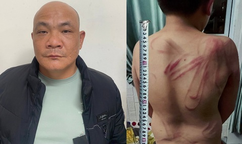 Khởi tố người cha bạo hành, dùng dây nịt cột cổ con dắt đi như dắt chó - Ảnh 1. Khởi tố người cha bạo hành, dùng dây nịt cột cổ con dắt đi như dắt chó - Ảnh 1.