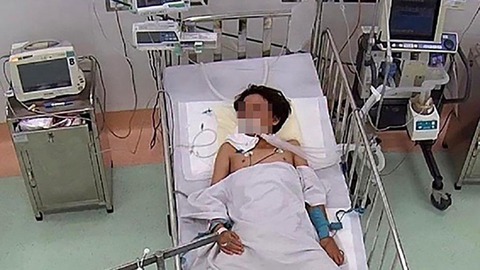 Trẻ viêm mô tế bào, áp xe vì đắp thuốc lá lên vết thương - Ảnh 1. Trẻ viêm mô tế bào, áp xe vì đắp thuốc lá lên vết thương - Ảnh 1.