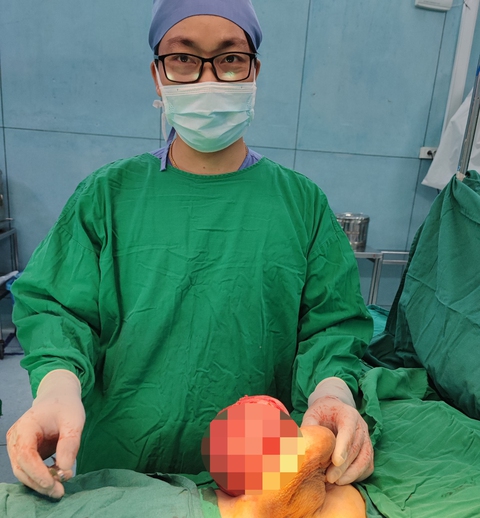 Thiếu nữ 15 tuổi mang khối u vú hiếm gặp - Ảnh 1. Thiếu nữ 15 tuổi mang khối u vú hiếm gặp - Ảnh 1.