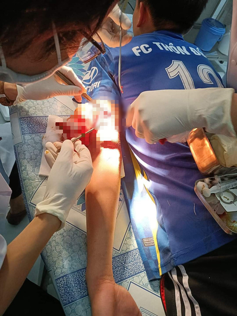 Nam sinh lớp 9 dùng ‘phóng lợn’ chém bạn học để giải quyết mâu thuẫn - Ảnh 1. Nam sinh lớp 9 dùng ‘phóng lợn’ chém bạn học để giải quyết mâu thuẫn - Ảnh 1.
