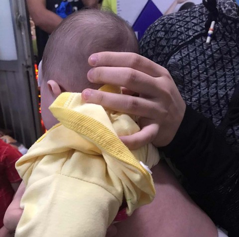 Cảnh giác khi bé 4 tháng tuổi sốt xuất huyết giả dạng là sốt phát ban - Ảnh 1. Cảnh giác khi bé 4 tháng tuổi sốt xuất huyết giả dạng là sốt phát ban - Ảnh 1.