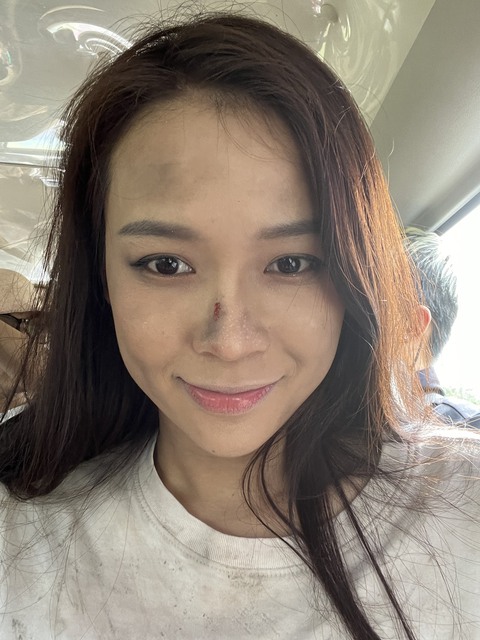 Sam rơi xuống thác, mặt sưng phù nửa năm vì quay phim kinh dị - Ảnh 5. Sam rơi xuống thác, mặt sưng phù nửa năm vì quay phim kinh dị - Ảnh 5.