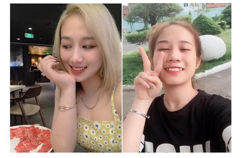 Phương pháp niềng răng trong suốt thu hút giới trẻ - Ảnh 2. Phương pháp niềng răng trong suốt thu hút giới trẻ - Ảnh 2.