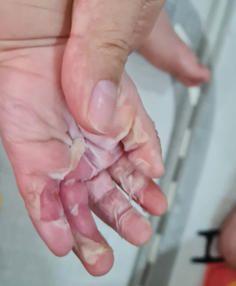 Vụ tai biến sản khoa tại Bệnh viện FV, thanh tra Sở Y tế đã vào cuộc - Ảnh 1. Vụ tai biến sản khoa tại Bệnh viện FV, thanh tra Sở Y tế đã vào cuộc - Ảnh 1.