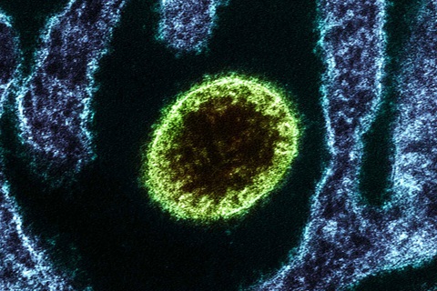 Vaccine chống virus Nipah nguy hiểm, hiệu quả sau 3 ngày tiêm - Ảnh 1. Vaccine chống virus Nipah nguy hiểm, hiệu quả sau 3 ngày tiêm - Ảnh 1.