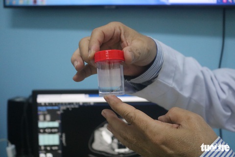 Xương cá nằm trong bàng quang phát triển thành khối áp xe khủng - Ảnh 1. Xương cá nằm trong bàng quang phát triển thành khối áp xe khủng - Ảnh 1.