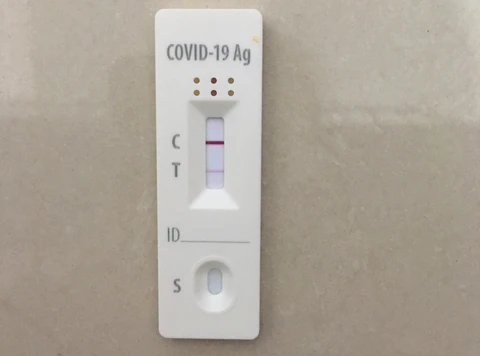 Đọc kết quả xét nghiệm nhanh COVID-19 bao lâu là chính xác? - Ảnh 1. Đọc kết quả xét nghiệm nhanh COVID-19 bao lâu là chính xác? - Ảnh 1.