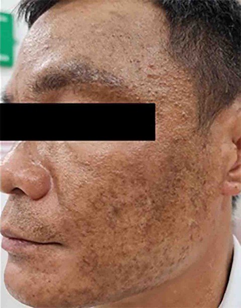 Tia cực tím mức nguy hại rất cao sẽ gây ra nguy cơ gì? - Ảnh 2. Tia cực tím mức nguy hại rất cao sẽ gây ra nguy cơ gì? - Ảnh 2.