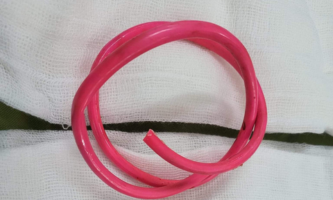 Dây điện dài 30cm được phát hiện trong bàng quang người đàn ông 53 tuổi - Ảnh 1. Dây điện dài 30cm được phát hiện trong bàng quang người đàn ông 53 tuổi - Ảnh 1.