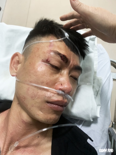 Dân tố bị đánh chấn thương sọ não khi được ‘mời’ về trụ sở, công an nói tự lăn dẫn tới bị thương - Ảnh 1. Dân tố bị đánh chấn thương sọ não khi được ‘mời’ về trụ sở, công an nói tự lăn dẫn tới bị thương - Ảnh 1.
