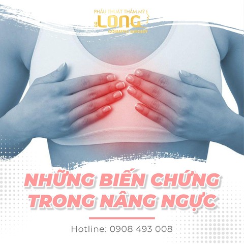 Bác sĩ Long chia sẻ kinh nghiệm nâng ngực - Ảnh 2. Bác sĩ Long chia sẻ kinh nghiệm nâng ngực - Ảnh 2.