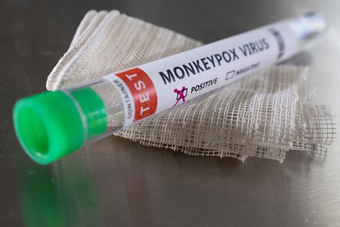 Anh giám sát bệnh đậu mùa khỉ, Đan Mạch có ca đầu tiên - Ảnh 1. Anh giám sát bệnh đậu mùa khỉ, Đan Mạch có ca đầu tiên - Ảnh 1.
