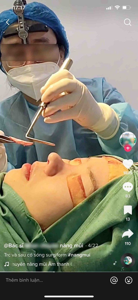Bác sĩ thẩm mỹ lên TikTok rao nâng mũi, sửa mũi, bệnh nhân coi chừng... mất mạng - Ảnh 2. Bác sĩ thẩm mỹ lên TikTok rao nâng mũi, sửa mũi, bệnh nhân coi chừng... mất mạng - Ảnh 2.