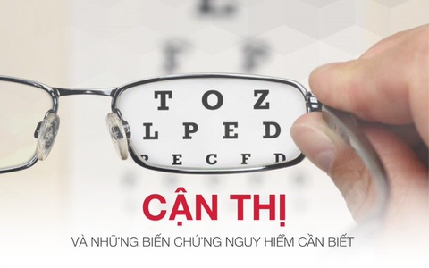 Cận thị và những biến chứng nguy hiểm cần biết - Ảnh 1. Cận thị và những biến chứng nguy hiểm cần biết - Ảnh 1.