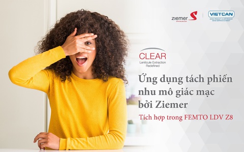 Cận thị và những biến chứng nguy hiểm cần biết - Ảnh 5. Cận thị và những biến chứng nguy hiểm cần biết - Ảnh 5.