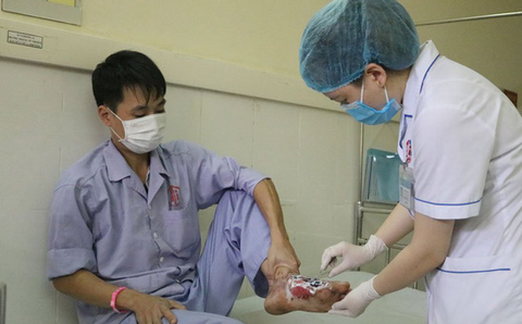 Hoại tử bàn chân do chữa bỏng bằng thuốc ‘lạ’ và lông gà - Ảnh 1. Hoại tử bàn chân do chữa bỏng bằng thuốc ‘lạ’ và lông gà - Ảnh 1.