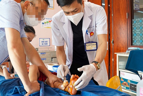 Bé 2 tuổi bị giập nát bàn chân, vỡ xương, đứt gân chân do cửa tự động - Ảnh 1. Bé 2 tuổi bị giập nát bàn chân, vỡ xương, đứt gân chân do cửa tự động - Ảnh 1.