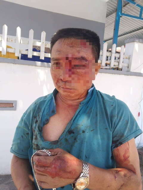 Mâu thuẫn vì 2 thùng hải sản, hành khách tố bị nhà xe đánh trọng thương - Ảnh 2. Mâu thuẫn vì 2 thùng hải sản, hành khách tố bị nhà xe đánh trọng thương - Ảnh 2.