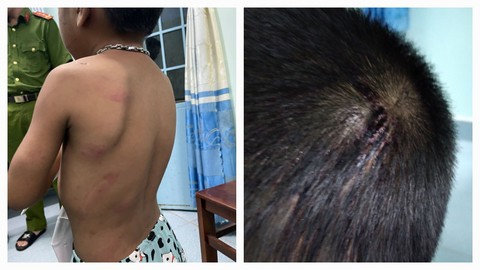 Bắt người cha 37 tuổi nhiều lần hành hạ con ruột 6 tuổi - Ảnh 1. Bắt người cha 37 tuổi nhiều lần hành hạ con ruột 6 tuổi - Ảnh 1.