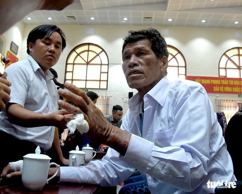 12 ngày không thức ăn và nước uống, 5 ngư dân Bình Thuận sinh tồn cách nào? - Ảnh 3. 12 ngày không thức ăn và nước uống, 5 ngư dân Bình Thuận sinh tồn cách nào? - Ảnh 3.
