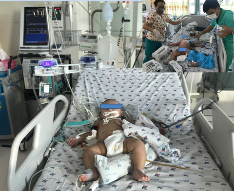 Bị chẩn đoán sai, nhiều trẻ sơ sinh mắc sốt xuất huyết nguy kịch - Ảnh 1. Bị chẩn đoán sai, nhiều trẻ sơ sinh mắc sốt xuất huyết nguy kịch - Ảnh 1.
