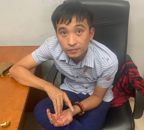 Tạm giữ tài xế say xỉn lao ôtô vào cây xăng ở Hà Nội khiến 8 người bị thương - Ảnh 1. Tạm giữ tài xế say xỉn lao ôtô vào cây xăng ở Hà Nội khiến 8 người bị thương - Ảnh 1.