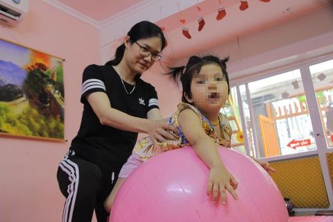 Trẻ chậm phát triển chữa được không? - Ảnh 1. Trẻ chậm phát triển chữa được không? - Ảnh 1.