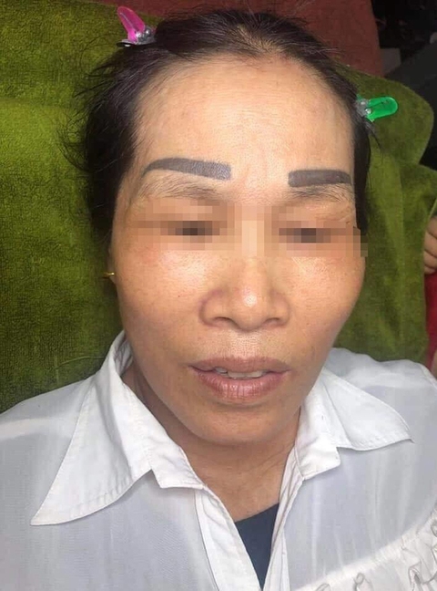 Chị em khóc thét khi đặt niềm tin nhầm thợ xăm lông mày - Ảnh 3. Chị em khóc thét khi đặt niềm tin nhầm thợ xăm lông mày - Ảnh 3.