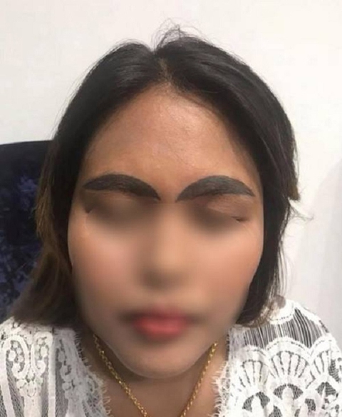 Chị em khóc thét khi đặt niềm tin nhầm thợ xăm lông mày - Ảnh 6. Chị em khóc thét khi đặt niềm tin nhầm thợ xăm lông mày - Ảnh 6.