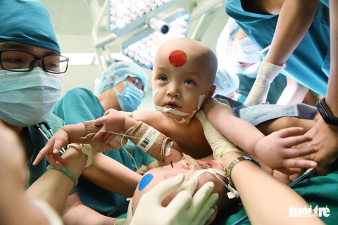 Đôi thiên thần Trúc Nhi - Diệu Nhi sau 2 năm tách rời giờ thế nào? - Ảnh 5. Đôi thiên thần Trúc Nhi - Diệu Nhi sau 2 năm tách rời giờ thế nào? - Ảnh 5.
