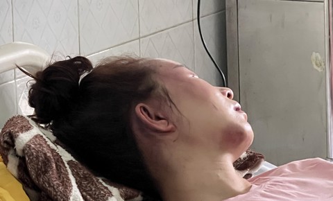 Khởi tố và bắt nam cán bộ quản lý thị trường vì hành vi đánh đập bạn gái dã man - Ảnh 2. Khởi tố và bắt nam cán bộ quản lý thị trường vì hành vi đánh đập bạn gái dã man - Ảnh 2.