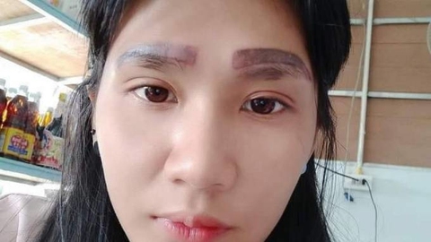 Cô gái sở hữu 2 cặp lông mày sau khi đi thẩm mỹ - Ảnh 1. Cô gái sở hữu 2 cặp lông mày sau khi đi thẩm mỹ - Ảnh 1.
