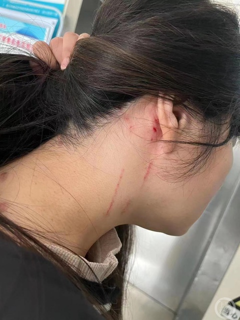 Hai mẹ con bị người mai mối đánh nhập viện vì từ chối đi xem mắt - Ảnh 2. Hai mẹ con bị người mai mối đánh nhập viện vì từ chối đi xem mắt - Ảnh 2.