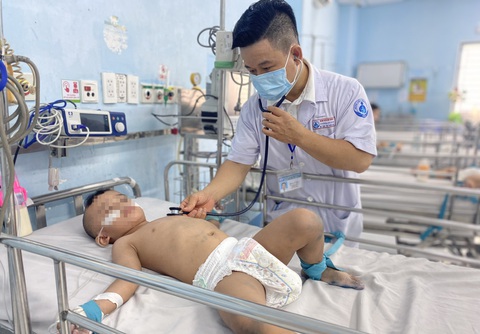 Bác sĩ CKII Dư Tuấn Quy, trưởng khoa nhiễm - thần kinh Bệnh viện Nhi đồng 1 (TP.HCM), thăm khám một bệnh nhi mắc tay chân miệng ngày 9-10 - Ảnh: XUÂN MAI Bác sĩ CKII Dư Tuấn Quy, trưởng khoa nhiễm - thần kinh Bệnh viện Nhi đồng 1 (TP.HCM), thăm khám một bệnh nhi mắc tay chân miệng ngày 9-10 - Ảnh: XUÂN MAI