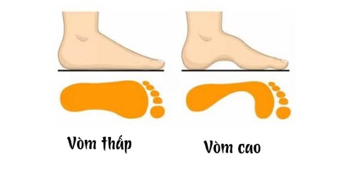 Vòm bàn chân nói gì về tính cách của bạn? - Ảnh 1. Vòm bàn chân nói gì về tính cách của bạn? - Ảnh 1.