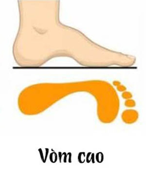 Vòm bàn chân nói gì về tính cách của bạn? - Ảnh 1. Vòm bàn chân nói gì về tính cách của bạn? - Ảnh 1.