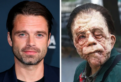 12 ngôi sao Hollywood hoàn toàn 'biến mất' vì vai diễn của mình - Ảnh 2. Sebastian Stan trong A Different Man được nhận xét là: "Không thể nhận ra!".