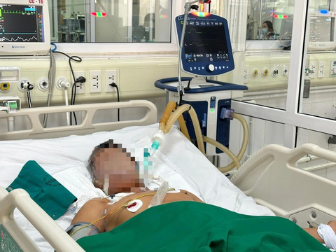 Người đàn ông nguy kịch, thở máy do mắc uốn ván sau khi cắt trĩ tại nhà - Ảnh: BVCC Người đàn ông nguy kịch, thở máy do mắc uốn ván sau khi cắt trĩ tại nhà - Ảnh: BVCC