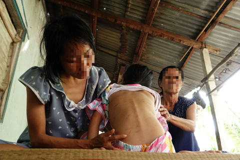 Bắt tạm giam thanh niên đánh đập hai mẹ con ‘vợ hờ’ tàn bạo - Ảnh 1. Nam thanh niên đánh đập hai mẹ con "vợ hờ" gây thương tích đầy mình - Ảnh: LINH KỲ