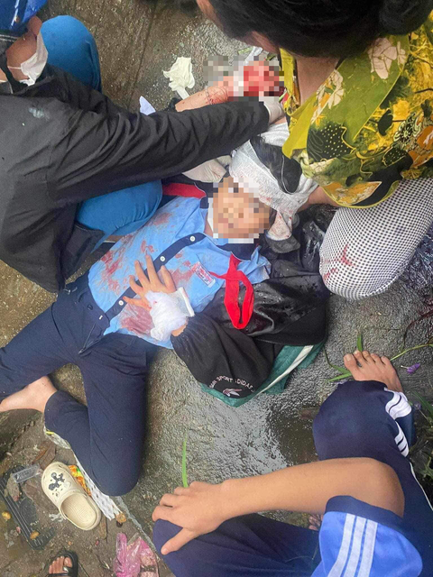 Xác minh thông tin nữ sinh bị người tâm thần dùng búa đánh chấn chương sọ não - Ảnh 1. Hiện trường nữ sinh lớp 6 ở Huế nghi bị người tâm thần tấn công đến chấn thương sọ não - Ảnh: mạng xã hội