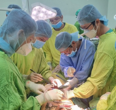 Bị cọc nhọn đâm xuyên khi té từ trên cao, được bác sĩ phẫu thuật cấp cứu - Ảnh 1. Các bác sĩ phẫu thuật cấp cứu cho nạn nhân bị cọc nhọn đâm xuyên - Ảnh: BV cung cấp