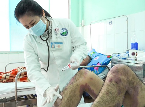 Nghe "thầy" trên mạng, người bệnh vảy nến bị tróc vảy toàn thân - Ảnh 1. Bác sĩ Bệnh viện Da liễu TP.HCM điều trị cho một bệnh nhân mắc bệnh vảy nến tự mua thuốc trên mạng uống - Ảnh: BVCC