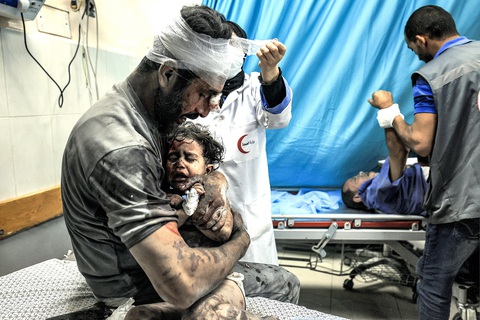 Israel vượt mọi "giới hạn đỏ" ở Gaza? - Ảnh 1. Người đàn ông bị thương ôm chặt đứa bé đang la khóc tại một bệnh viện ở phía nam Dải Gaza vào ngày 24-10 - Ảnh: AFP