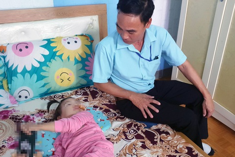 Bé gái 3 tuổi phải khâu 16 mũi do chó nhà hàng xóm tấn công - Ảnh 1. Bé gái 3 tuổi bị chó hàng xóm tấn công gây thương tích vùng mặt và tai, phải khâu 16 mũi - Ảnh: AN BÌNH